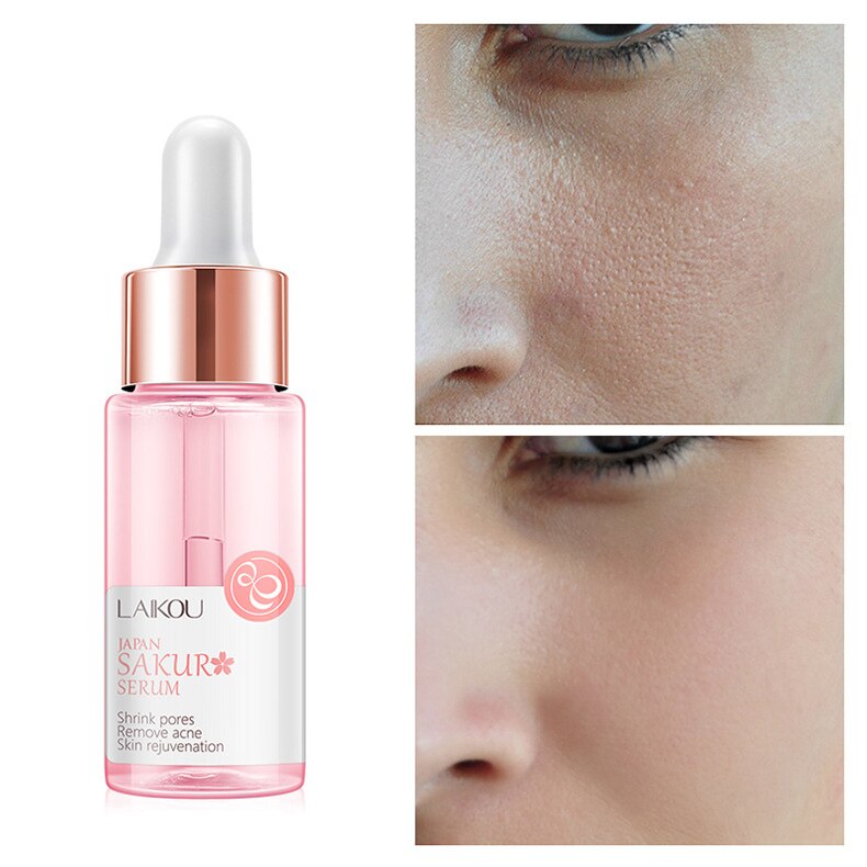 1PC Sakura Face Serum Shrink Pores Remove Acne